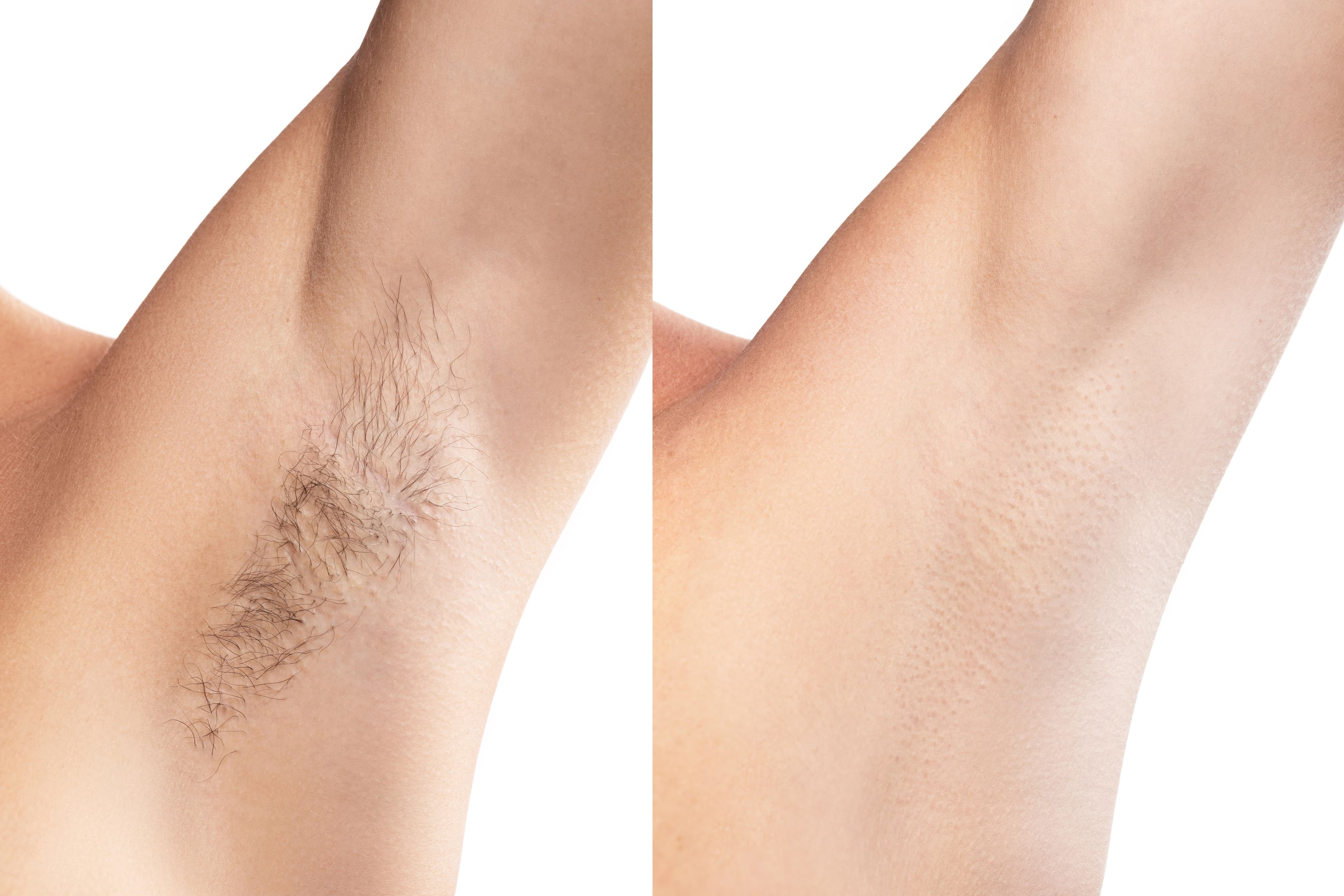 Smooth flawless underarms with premium waxing
