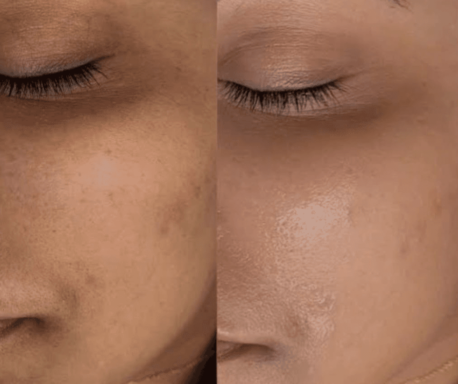 Fresh, glowing skin with our expert facial treatment